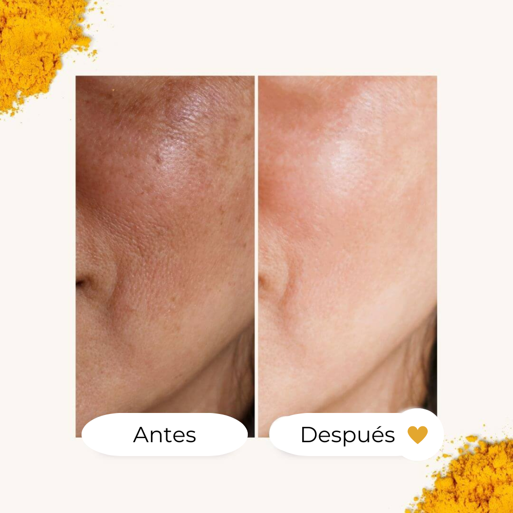 TRATAMIENTO  Esencial ACEITE de Curcuma Contra LAS MANCHAS