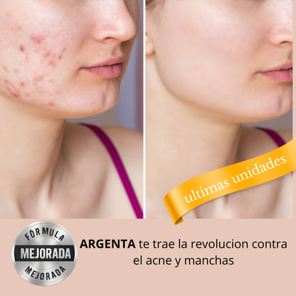 Nuestro Serum ELIMINA en Dias Las MANCHAS y el ACNE 👉🎁 llevate de REGALO este Limpiador Facial®
